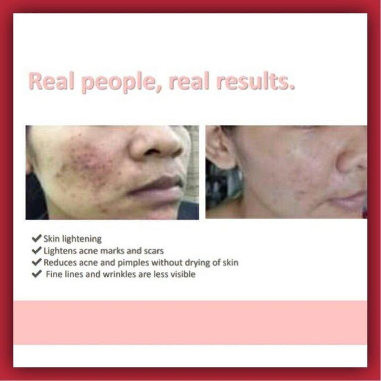 [AUTHENTIC] Eight Karats Eighteen Vitaskin Nutricosmetic Beauty