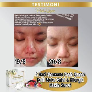 (Category: ) located in . Submitted by mikas_store (Listing ID 1031037838, Image 1). Description: .