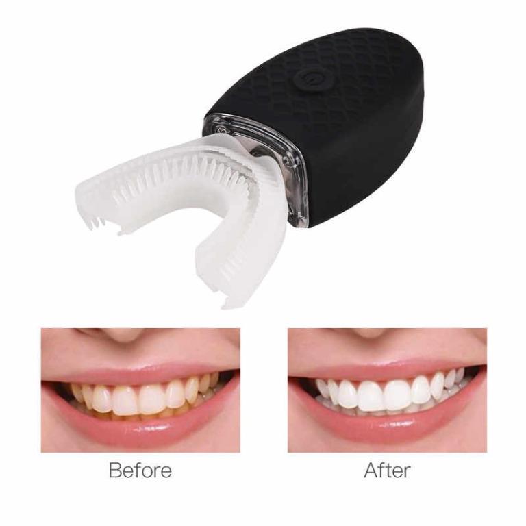 sonic ultrasonic tooth cleaner