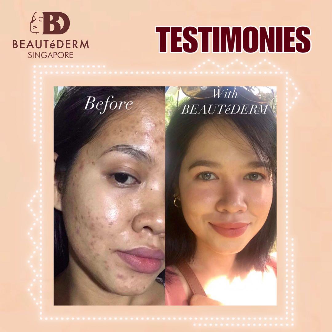 beautederm best skincare anti aging beauty set