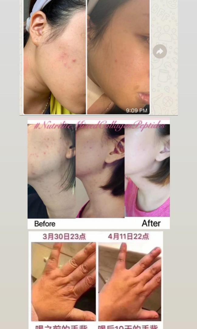 Nutrilite Mixed Collagen Peptide Drink Health Beauty Face Skin Care On Carousell Nutrilite mixed collagen peptide drink. nutrilite mixed collagen peptide drink