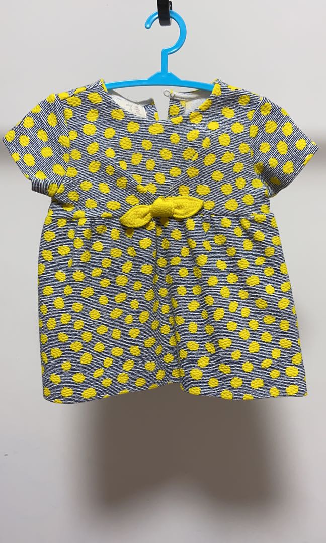 zara baby dress