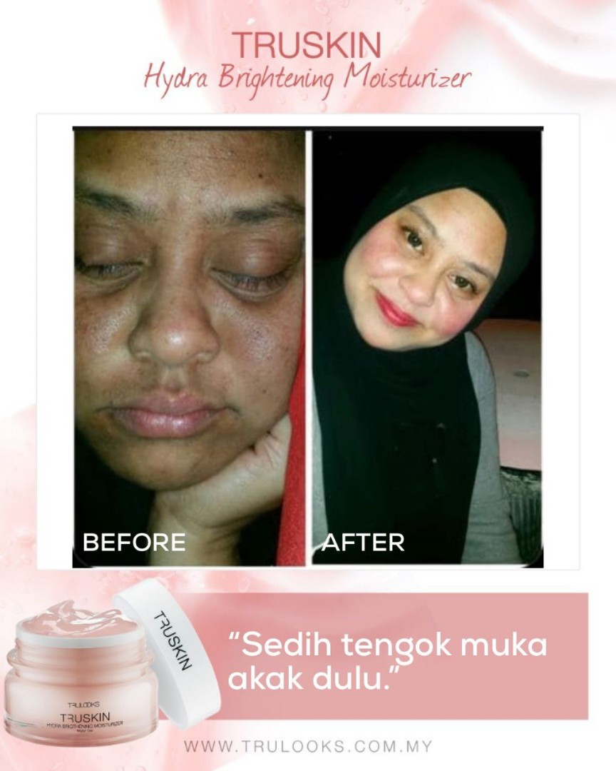 harga truskin moisturizer