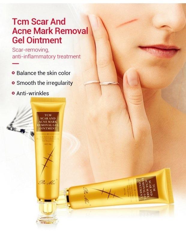 tcm acne scar removal