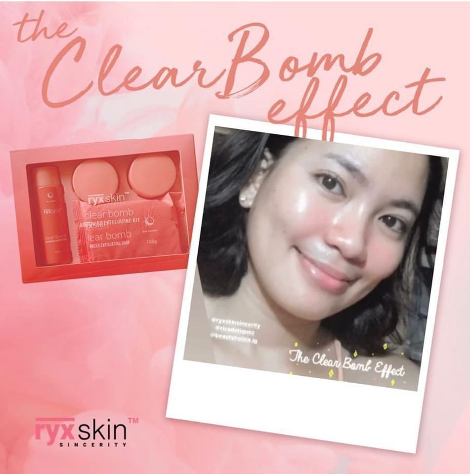RYX Skincerity Clearbomb (Category: Face Care) located in Mandaluyong City. Submitted by charlaloooo (Listing ID 1033460210, Image 2). Description: Just like bombs, the clear bomb effect will shock you! Check it out! The clear bomb effect will make you stand out!! 🥰💣✨ #ClearBomb #RyxSkincerity #SlayTheDay #RyxSkincerityMandaluyong.
