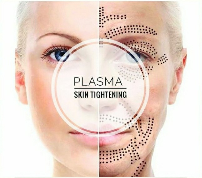 plasma skin tightening