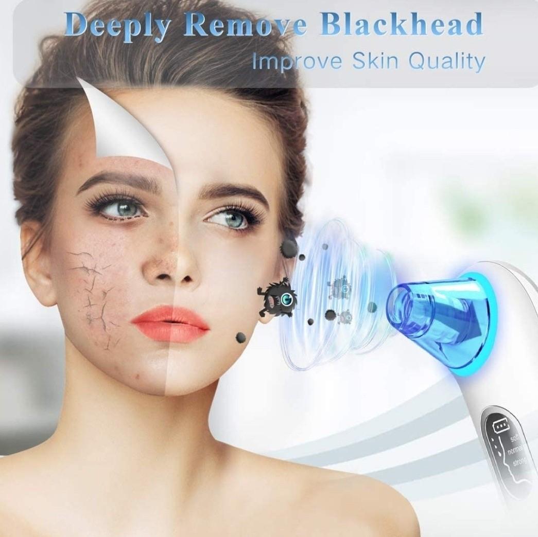 Lonove blackhead remover vacuum sales pore cleaner