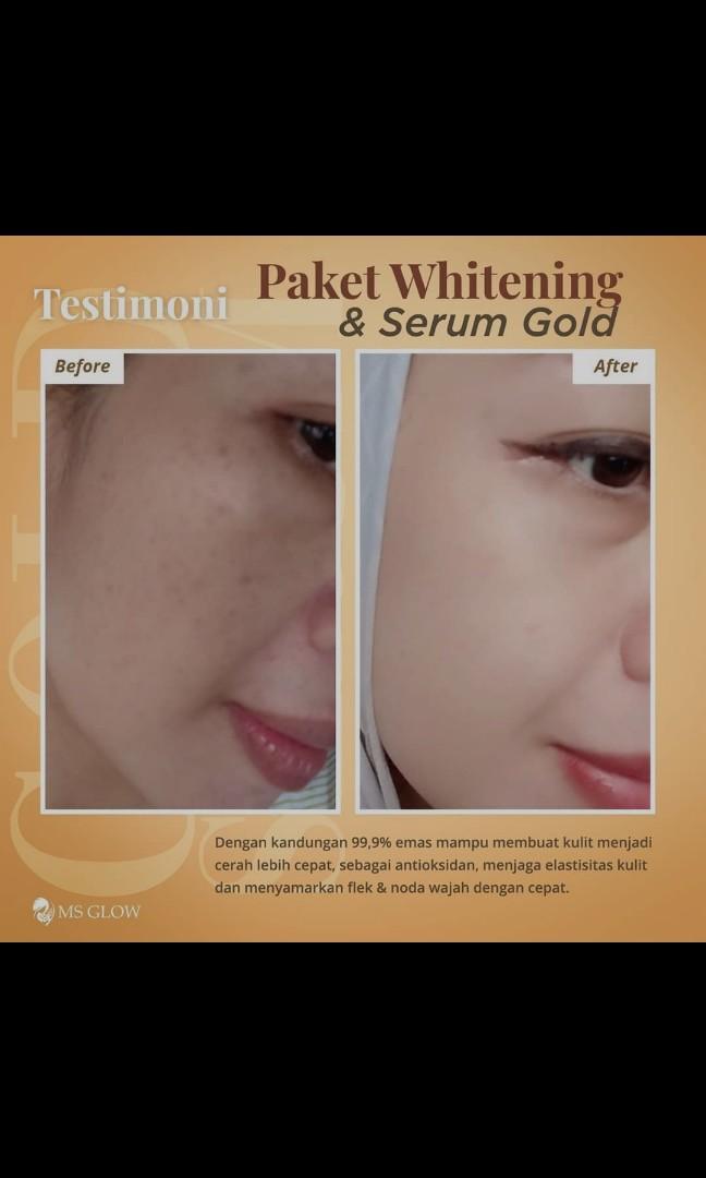 Msglow In Singapore Beauty Personal Care Face Face Care On Carousell