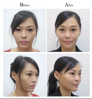 （分類：）位於 。 由 click_pretty 提交（商品編號 1061469075，圖片 1）。簡介： 。