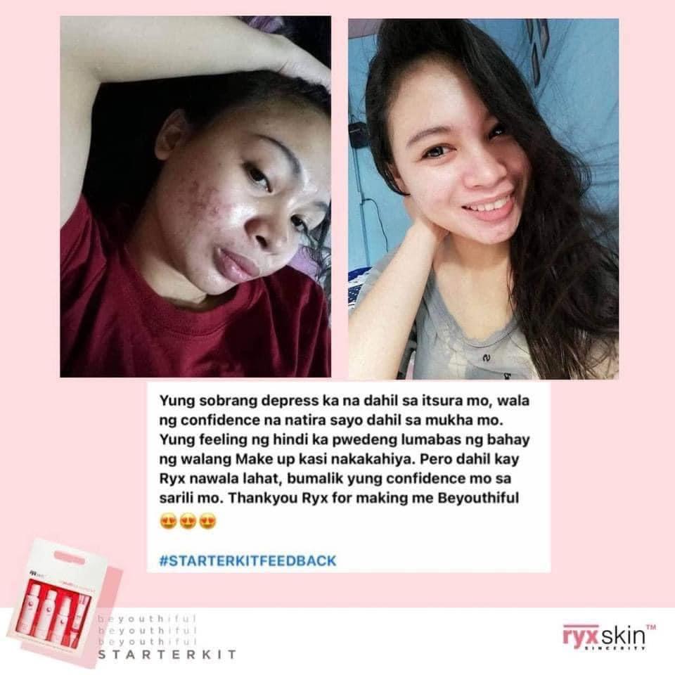 RYX Starter Kit (Category: Face Care) located in Mandaluyong City. Submitted by charlaloooo (Listing ID 1119110880, Image 2). Description: SLAY THE DEAD SKIN AWAY ✨ Exfoliate. Exfoliate. Exfoliate for an acne-free radiant skin. Say bye bye to black heads, white heads, blemishes without using harsh chemicals on your skin. ❤️ Formulated just for YOU! 😍 #SlayTheDay #Ryx #Ryxified #RyxSkinSincerity #RyxSkincerity #RyxSkin #beYOUTHifulStarterKit #Sta