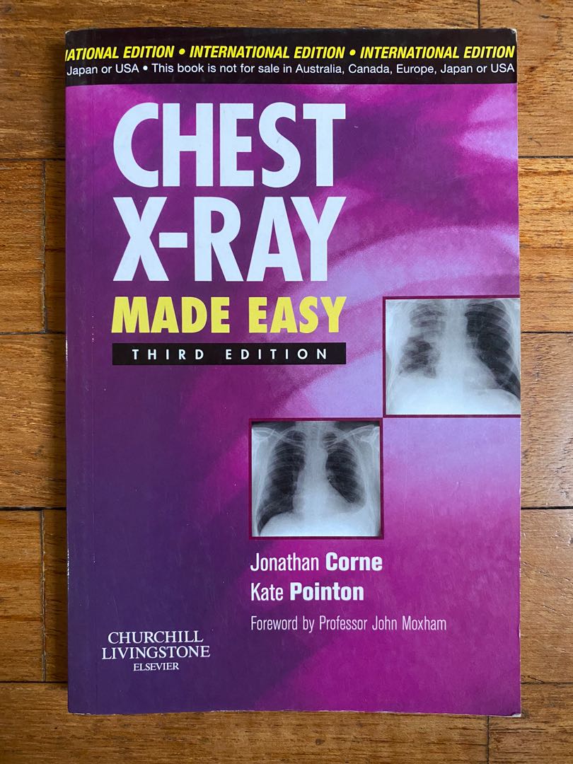 Chest XRay Made Easy Third edition, Hobbies & Toys, Books & Magazines