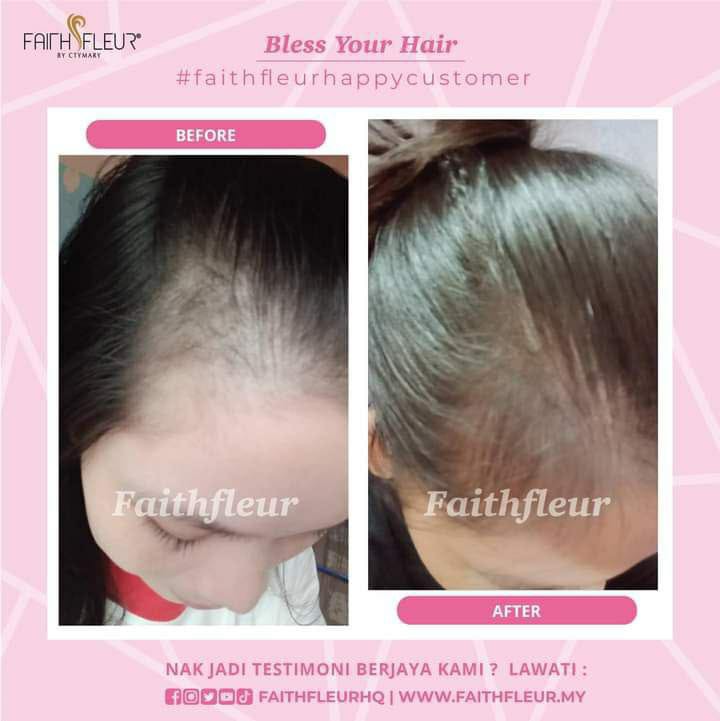 Serum Blessyourhairwithfaithfleur Beauty Personal Care Hair On Carousell