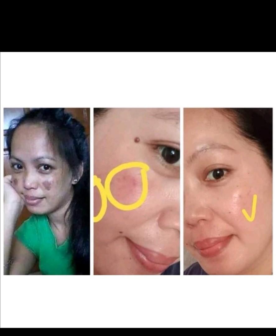 Pekas cream, Beauty & Personal Care, Face, Face Care on Carousell