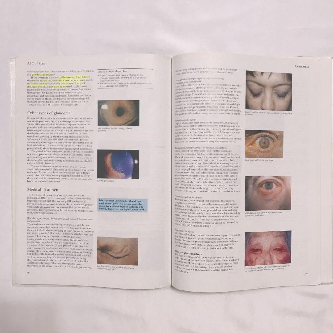 [MEDICAL TEXTBOOK] ABC of Eyes / Ophthalmology (Clinical / MBBS