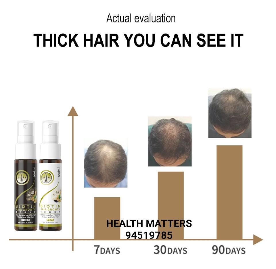 ♥️ Hair GROWTH Biotin serum kit Day & Night. Anti hair loss, treat damaged hair, thinning hair. Stronger and Thicker hair. 30ml X 2. Suitable for men & women, Beauty & Personal ♥️ Hair GROWTH Biotin serum kit Day & Night. Anti hair loss, treat damaged hair, thinning hair. Stronger and Thicker hair. 30ml X 2. Suitable for men & women, Beauty & Personal