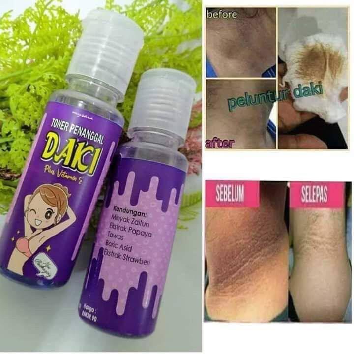Magic Spray (Category: Body Care) located in Pasir Puteh. Submitted by mia_asyraf (Listing ID 1127136398, Image 1). Description: TONER DAKI RM10.50x1.