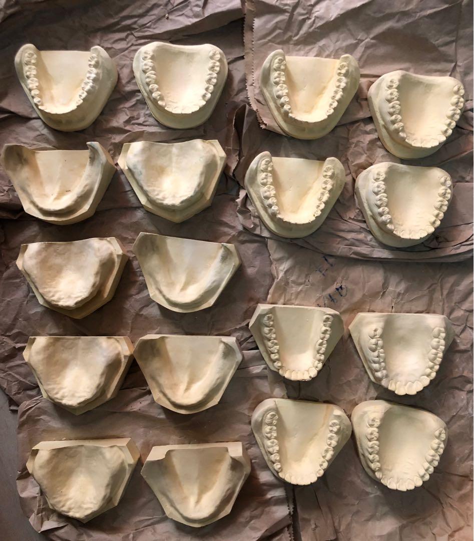 PATIENTS DENTULOUS AND EDENTULOUS CAST, Commercial & Industrial