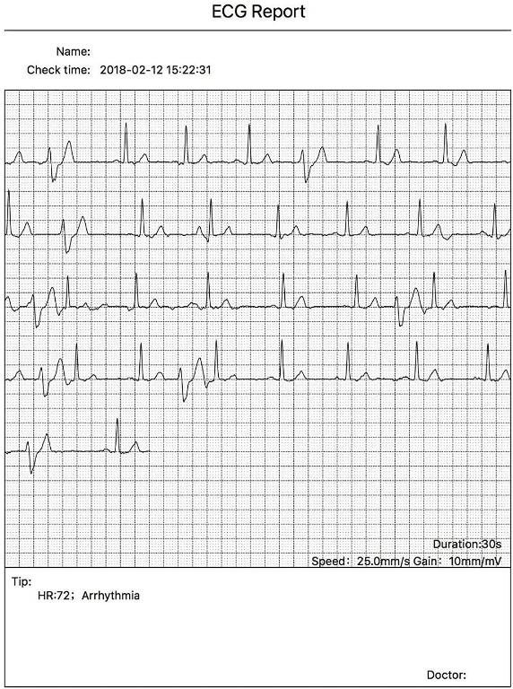 CONTEC Portable ECG/EKG Monitor PC Software Electrocardiogram Bluetooth