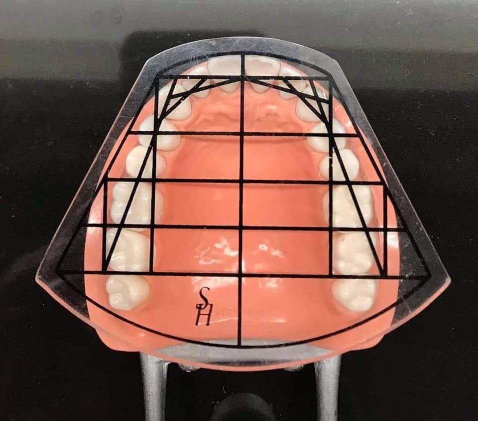 guide plate Templates teeth arrangement on denture work Dental, Health
