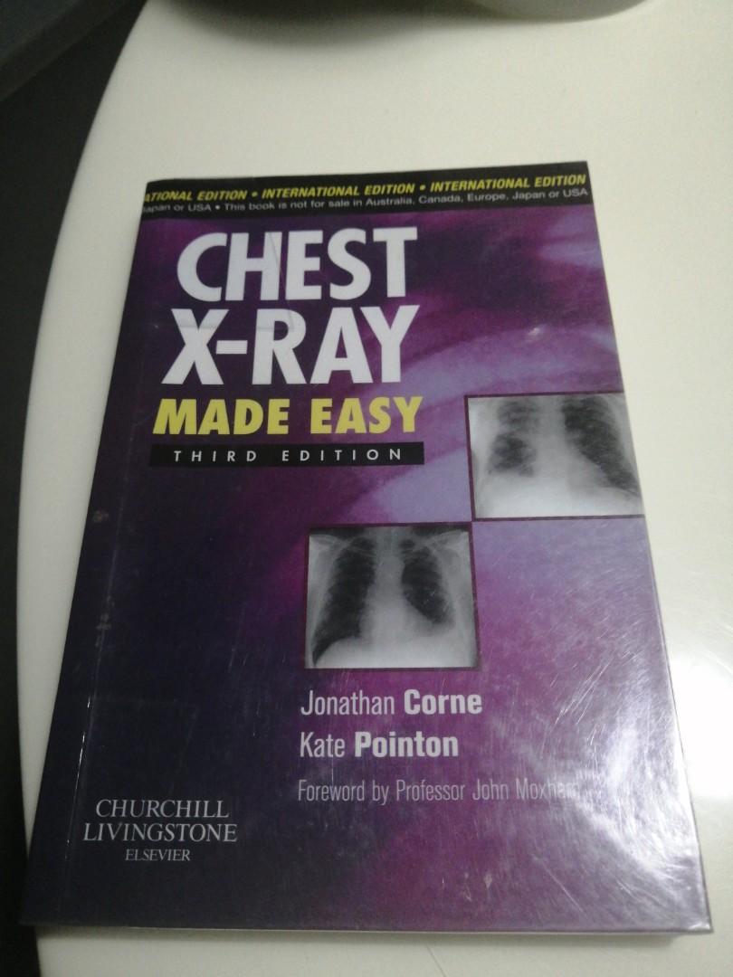 Chest x ray made easy, Hobbies & Toys, Books & Magazines, Textbooks on