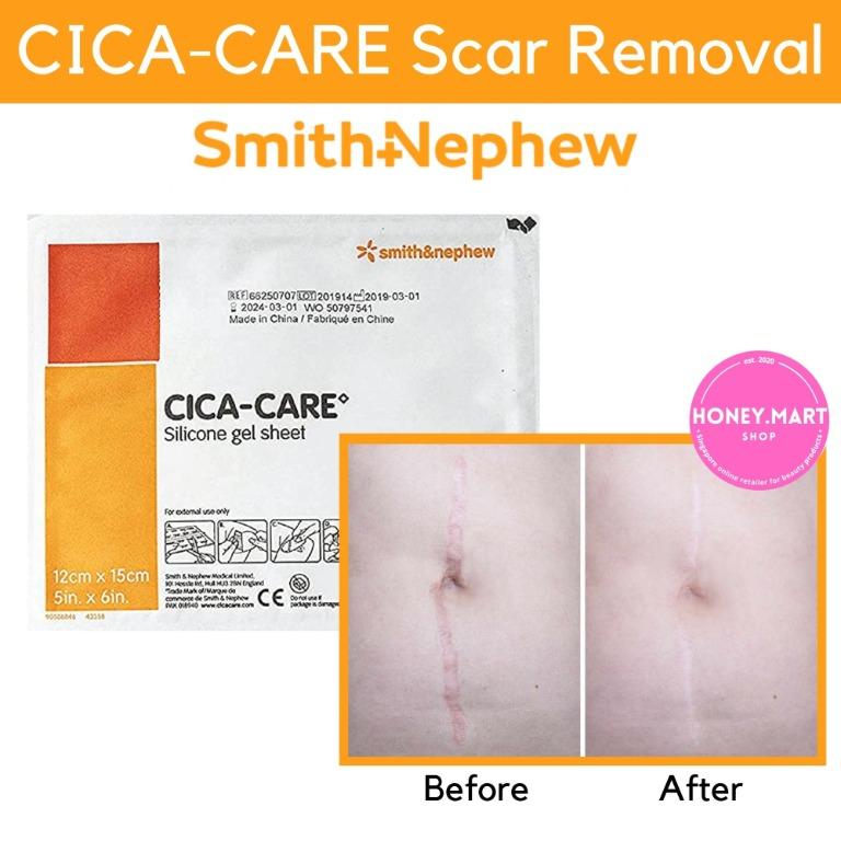 Cica care clearance silicone gel sheet