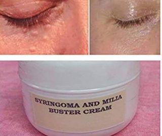 Syringoma and milia buster cream