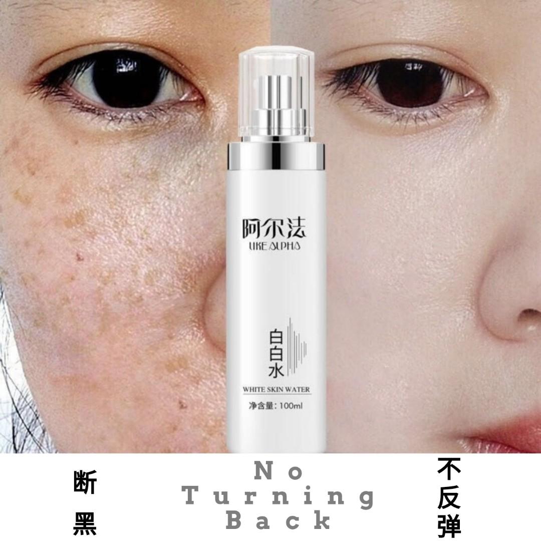 White Water Uke Alpha Fights Melanin Pigmentation Age Spots Sun Spots Liver Spots Uneven Skin Tone No Rebound 阿尔法 白白水 断黑 不反弹 Beauty Personal Care Face Face Care On Carousell