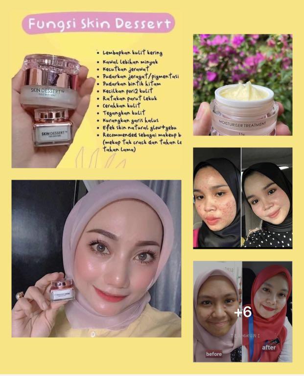 skin dessert moisturizer