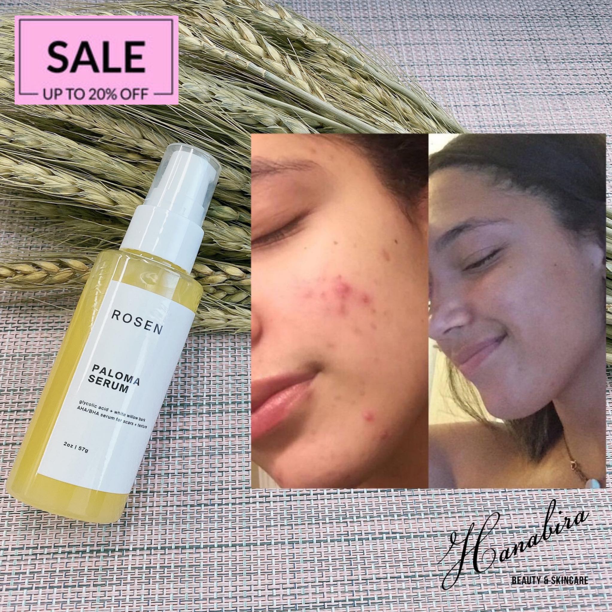 rosen skincare paloma serum