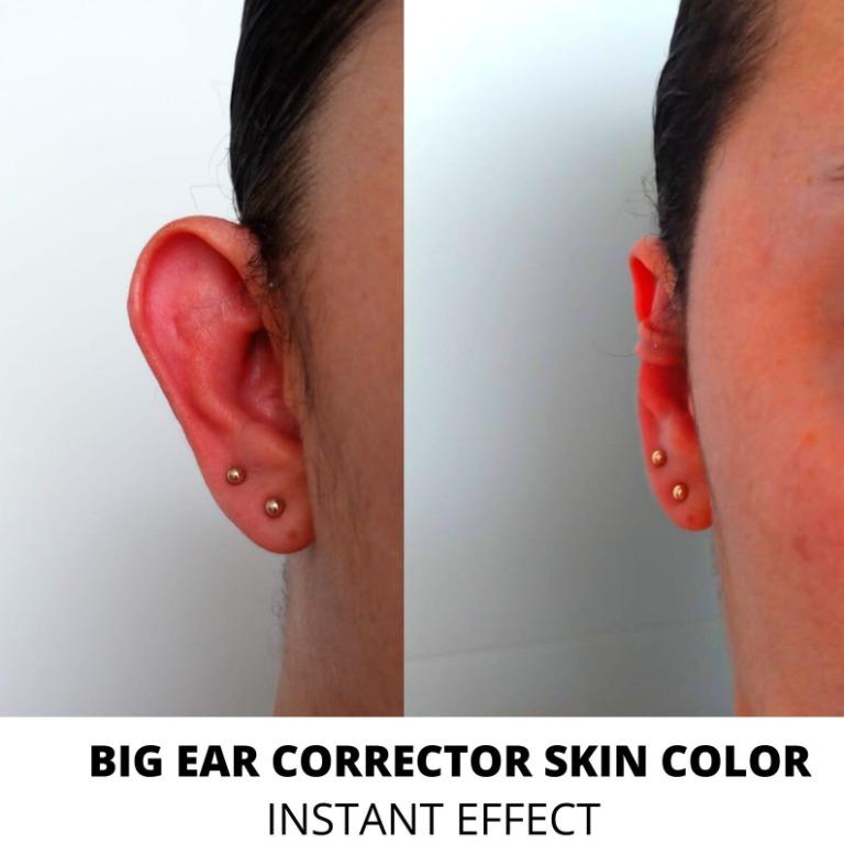 Protruding ear discount cuff