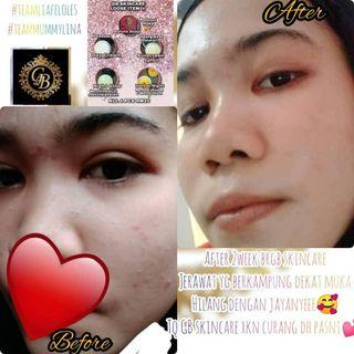 Gb skincare