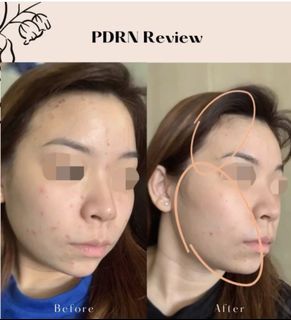 (Category: ) located in . Submitted by shebellabeautyandslimming (Listing ID 276208526, Image 1). Description: .