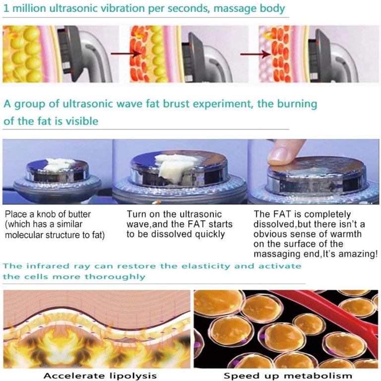 Ultrasonic fat burning machine top