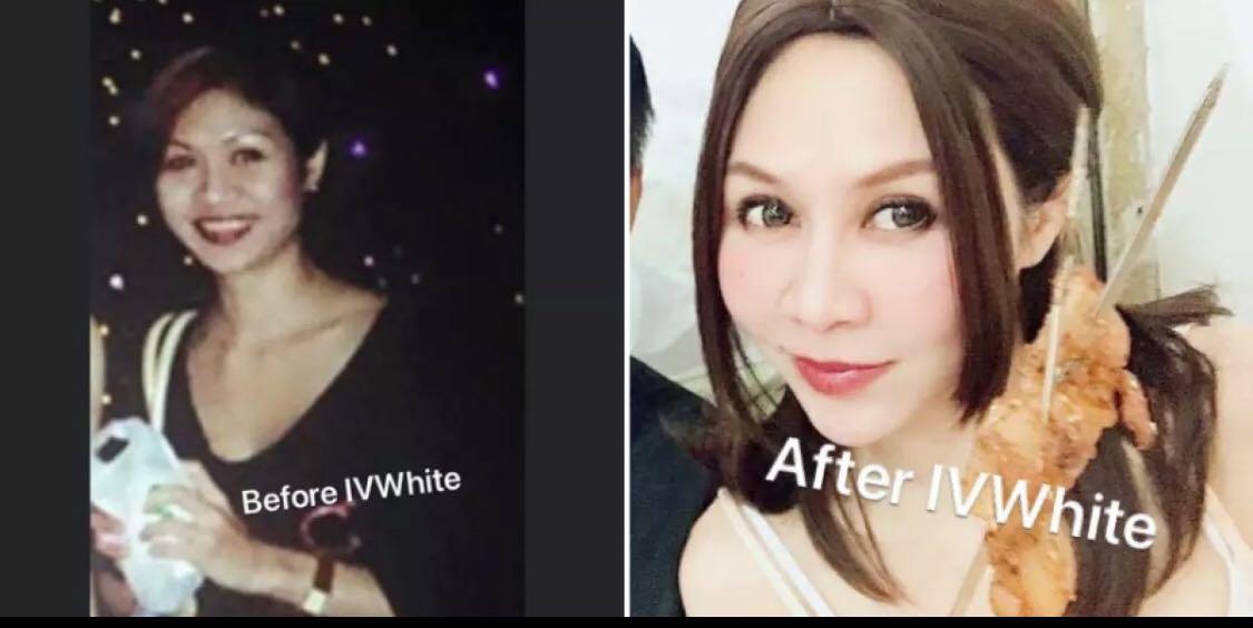 Achieve Korean Porcelain Fair Skin With Korea Ivwhite Beauty Personal Care Face Face Care On Carousell