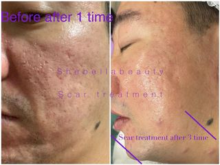 (Category: ) located in . Submitted by shebellabeautyandslimming (Listing ID 166529365, Image 1). Description: .