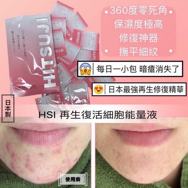 順豐到付 日本人瘋狂勁搶hitsuji 再生復活細胞能量液 28包入一包用2次 美容 化妝品 皮膚護理 Carousell