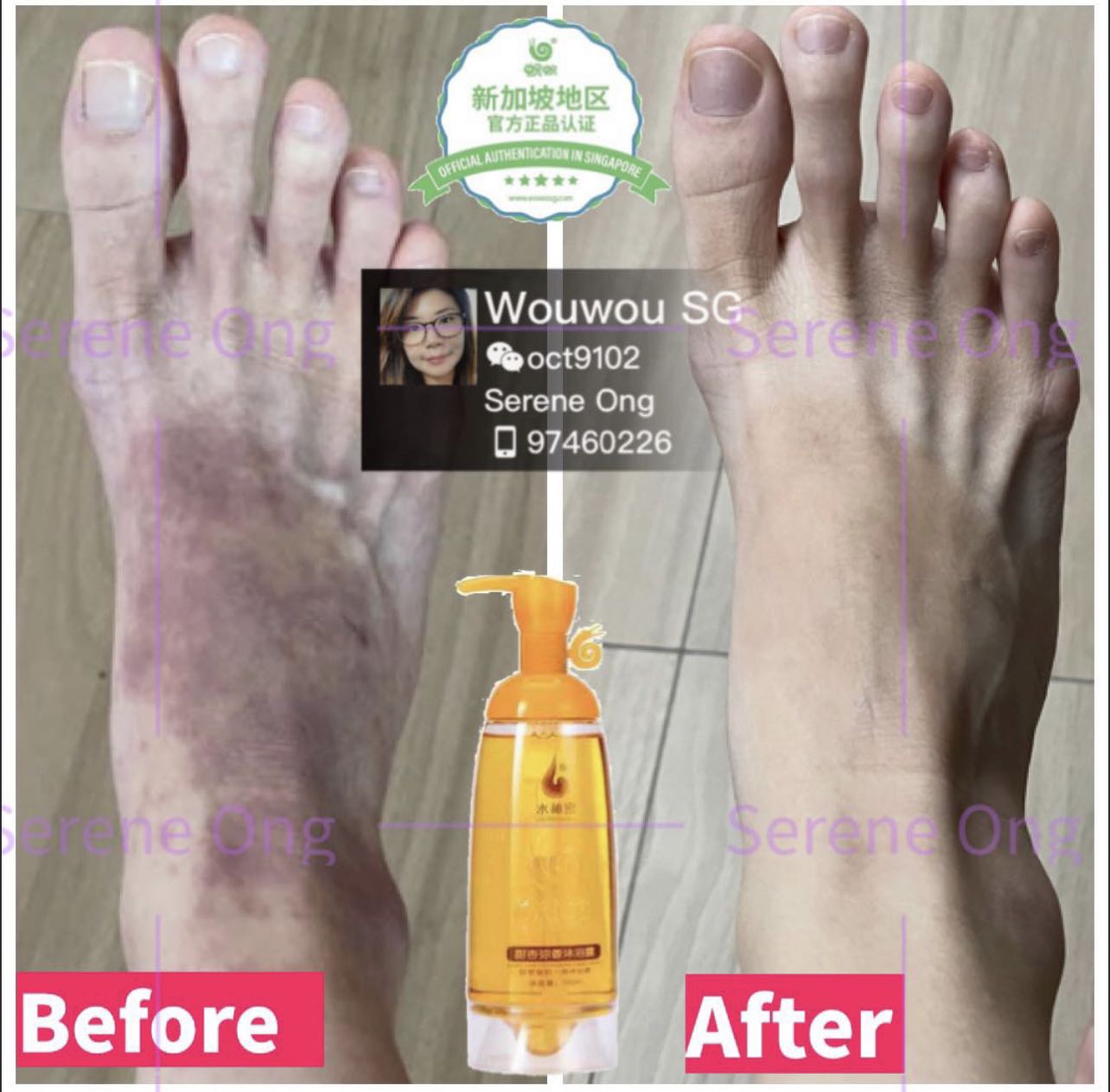 Ezcema Skin / Sensitive Skin / psoriasis Shower Gel , Beauty