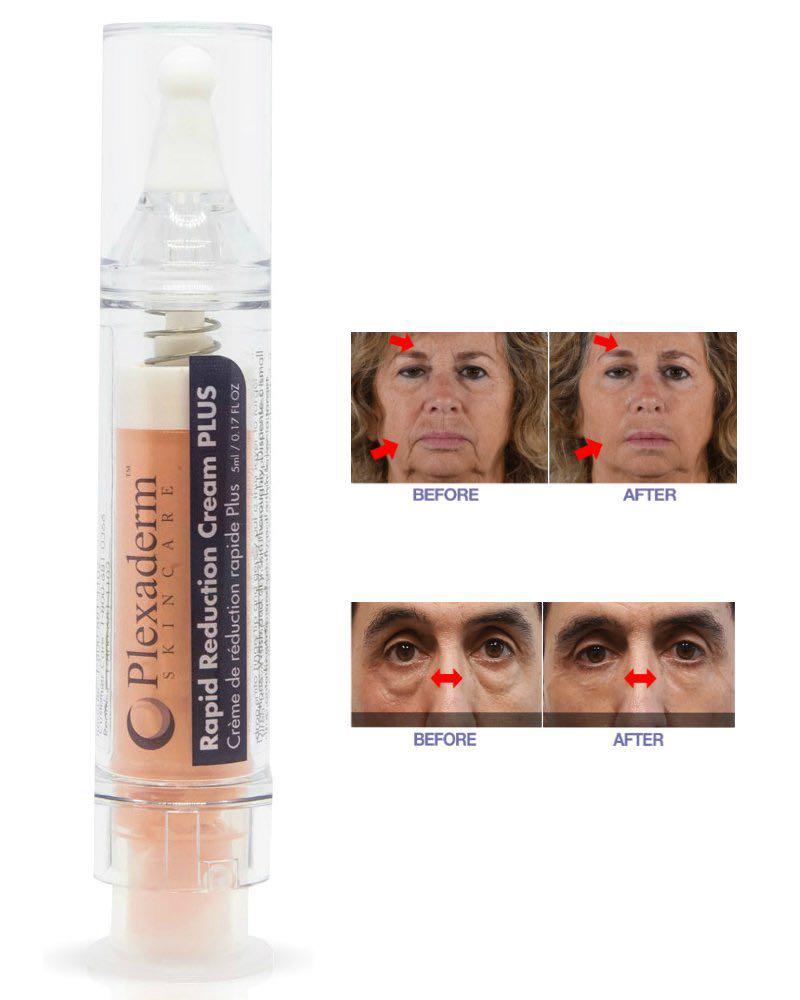 plexaderm rapid reduction