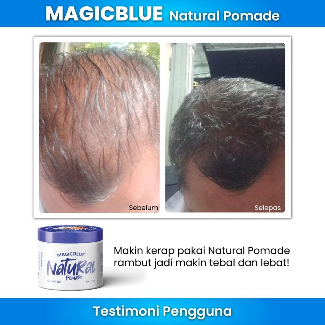 Pelebat Rambut Magicblue Health Beauty Hair Care On Carousell