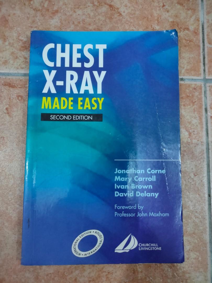 Chest xray made easy 2nd edition, Hobbies & Toys, Books & Magazines