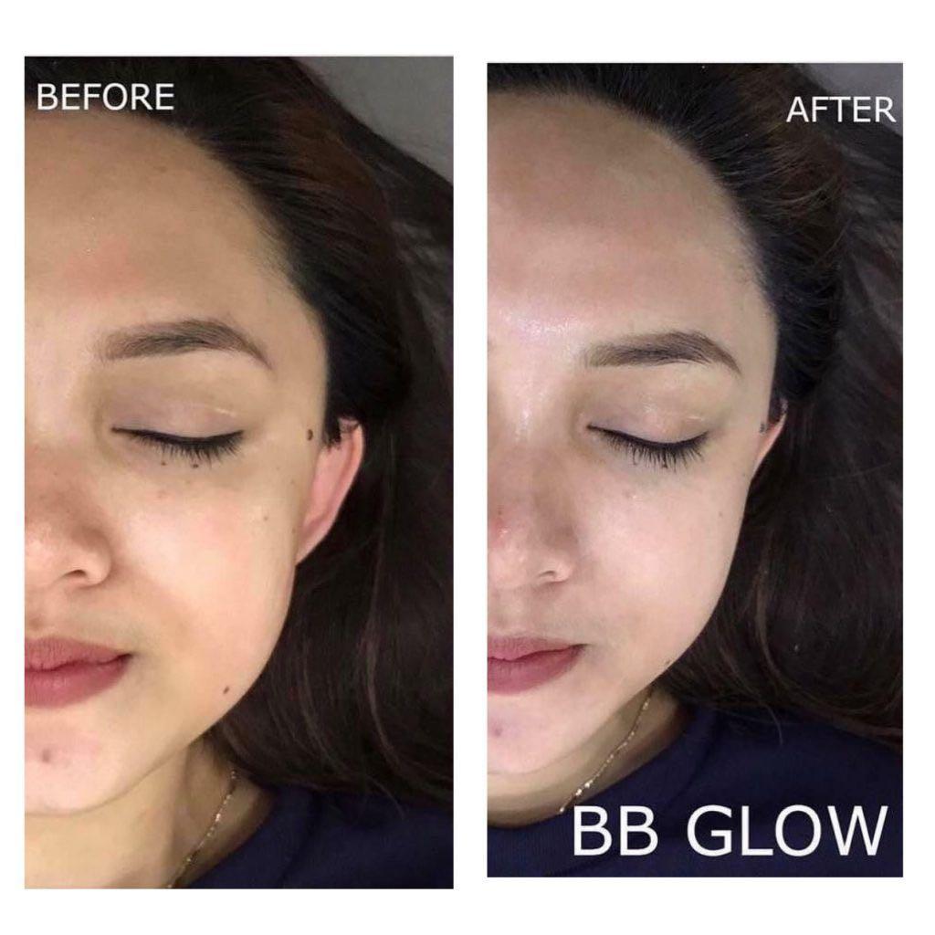 BB Glow skin treatment $80 ( Worth $200) taiseng m (Category: Beauty & Health Services) located in Singapore. Submitted by 93lashlounge (Listing ID 1074177497, Image 1). Description: BB Glow Treatment – is the most advanced development of Korean beauticians for a safe and intensive treatment, whitening, rejuvenation of the facial skin that gives it a soft glow. Radiant, even and with a silky porcelain glow – Korean women are famous for their flaw