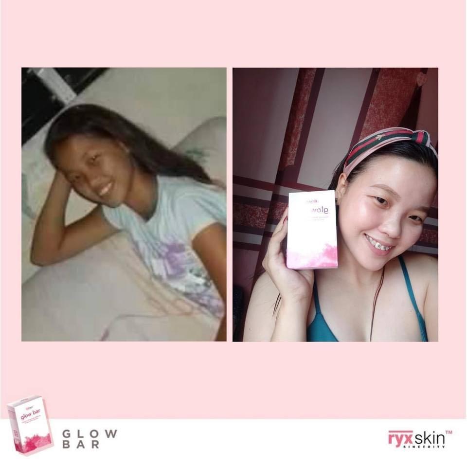 Ryx Glowbar (Category: Bath) located in Mandaluyong City. Submitted by charlaloooo (Listing ID 1081034514, Image 3). Description: The realest soap bar with pure active ingredients is here. Don’t settle for any face and body soap just because it’s available. Level up your standards with Ryx Skin Glow Bar. ❤️ Dare to experience a different bath time with Ryx Skin’s Glow Bar. Soothing, calming yet with micro-peeling for effective whitening and deep 