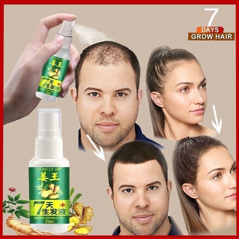 Free shipping instock!!!30ml ginger hair treatment hair growth serum spray,  Beauty & Personal Care, Hair on Carousell