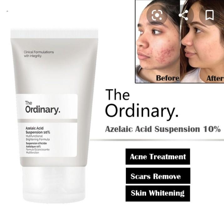 The Ordinary Azelaic Acid Suspension 10 30ml Beauty Personal Care Face Face Care On Carousell
