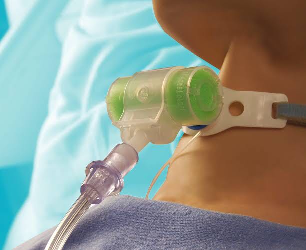 Hydro-Trach II HME with Oxygen Tubing, Health & Nutrition, Medical ...