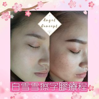 去斑. 去印. 去色素 皮膚護理 Collection item 2