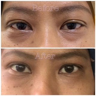 (Category: ) located in . Submitted by freenabeauty (Listing ID 1086860742, Image 1). Description: .