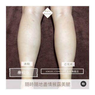 去去象腿走護理 做1次效果已有效果 瘦腿 小腿 尖沙咀 去去象腿走護理 做1次效果已有效果 瘦腿 小腿 尖沙咀