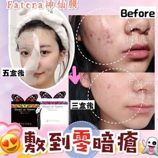 （分類：）位於 。 由 kkinggggg 提交（商品編號 1086211858，圖片 1）。簡介： 。