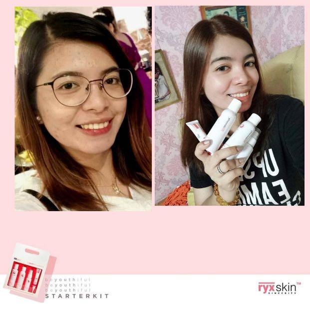 RYX Starter Kit (Category: Face Care) located in Mandaluyong City. Submitted by charlaloooo (Listing ID 1093592097, Image 2). Description: Hirap makahanap ng hiyang for your skin? Check this out! Your newly found holy grail, Ryx Skin’s BeYOUTHiful Starter Kit. ✨ A mild set perfect for any skin types and gender, start your rejuvenation process that will safely and gently flake away your damaged skin to reveal a much plump and more radiant face. Ge